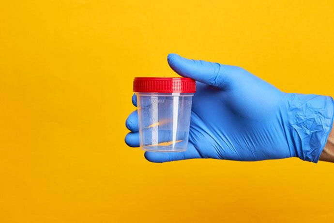 Does CBD Show Up on a Drug Test?